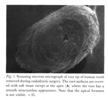 fig1.JPG