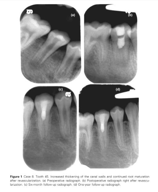 pic1